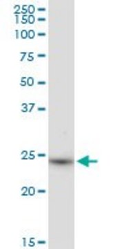 Anti-DHRS6 antibody produced in mouse
