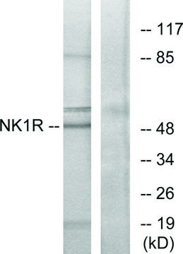 Anti-NK1R antibody produced in rabbit