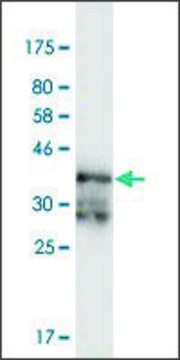 Monoclonal Anti-PRKAR2A, (N-terminal) antibody produced