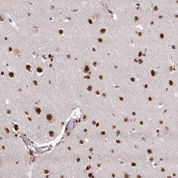 Anti-U2AF1 antibody produced in rabbit