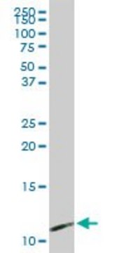 Anti-PPBP antibody produced in rabbit