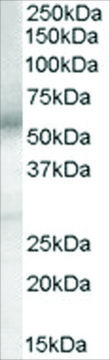 Anti-EP4 Prostaglandin Receptor antibody produced