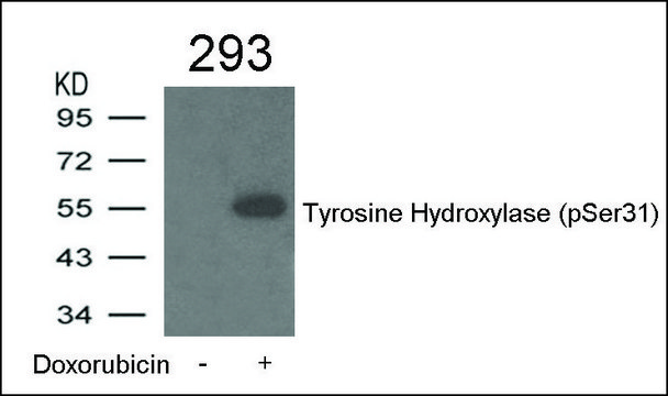 Anti-phospho-Tyrosine Hydroxylase (pSer³¹) antibody produced