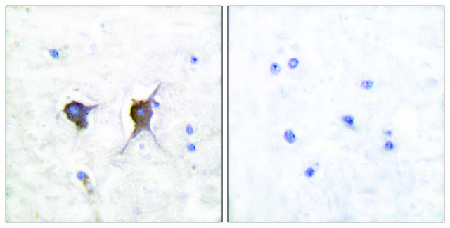 Anti-BAX antibody produced in rabbit