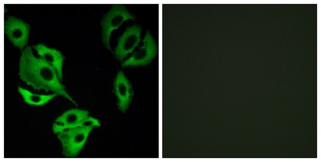 Anti-ADCK4 antibody produced in rabbit