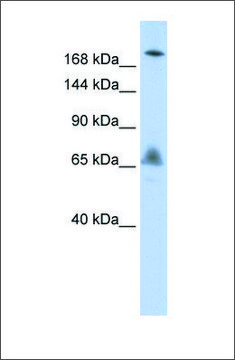 Anti-VPS8 antibody produced in rabbit
