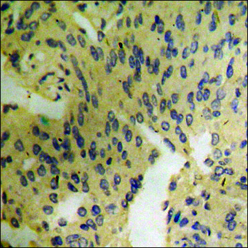 Anti-phospho-Catenin-? (pTyr???) antibody produced in
