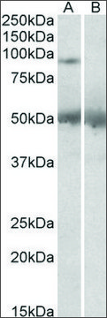 Anti-USP6 (C-terminal) antibody produced in