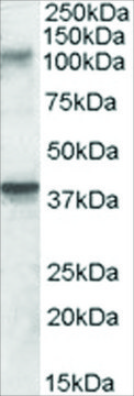 Anti-GRIK3/GLUR7 antibody produced in goat