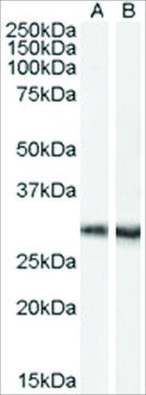 Anti-DCDC2A antibody produced in goat