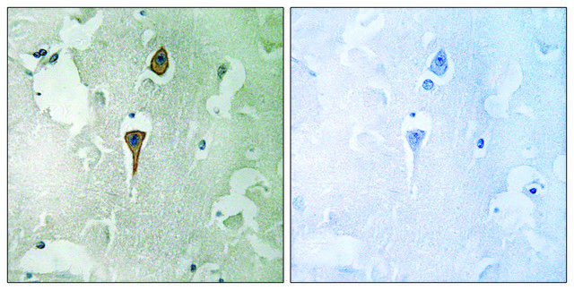 Anti-NMDAR1 antibody produced in rabbit