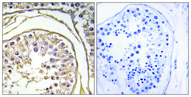 Anti-BAGE2 antibody produced in rabbit