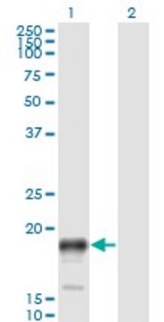 Monoclonal Anti-PSCA antibody produced in