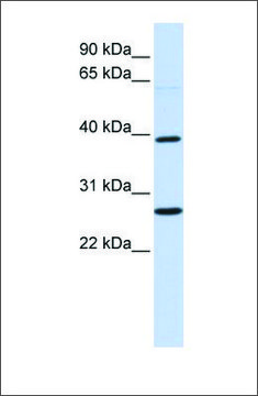 Anti-WNT16 antibody produced in rabbit