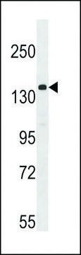ANTI-APG1 (ULK1) (CENTER) antibody produced