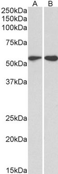 Anti-RDH5 antibody produced in goat