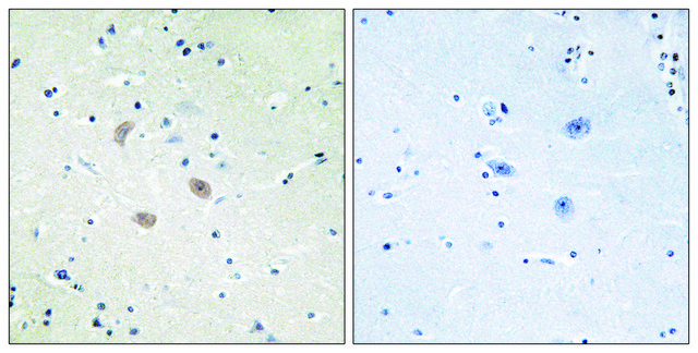 Anti-AKT2 antibody produced in rabbit