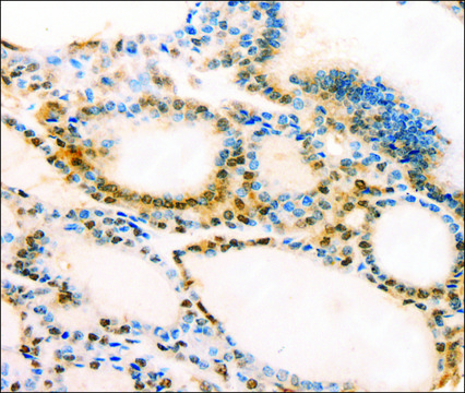 Anti-MUC16 antibody produced in rabbit