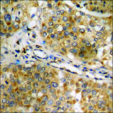 Anti-phospho-NF-kappaB p65 (pSer???) antibody produced