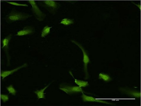 Monoclonal Anti-HGD, (C-terminal) antibody produced