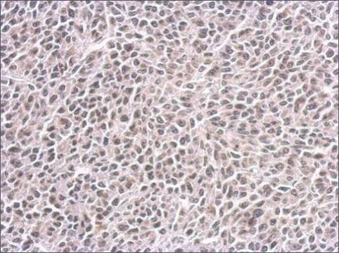 Monoclonal Anti-CENPF antibody produced in