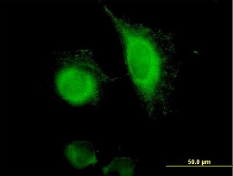 Anti-TACSTD1 antibody produced in mouse