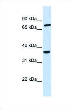 Anti-CCRL2 antibody produced in rabbit