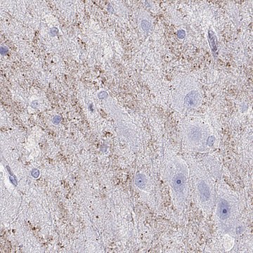 Anti-HHLA1 antibody produced in rabbit