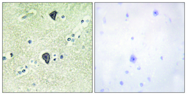 Anti-FGFR3 antibody produced in rabbit
