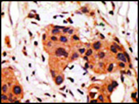 Anti-GJA8 (C-term) antibody produced in