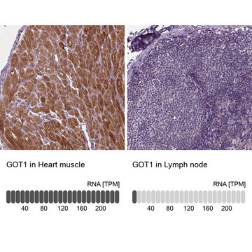 Anti-GOT1 antibody produced in rabbit