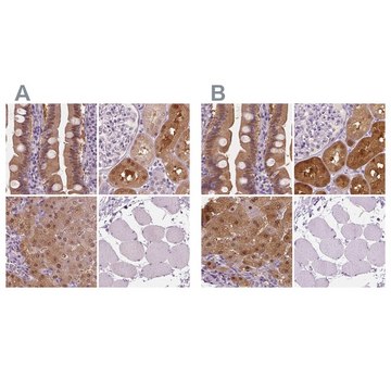 Anti-TKFC antibody produced in rabbit