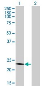 ANTI-RCV1 antibody produced in mouse