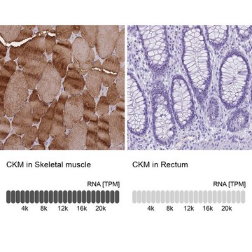 Anti-CKM antibody produced in rabbit
