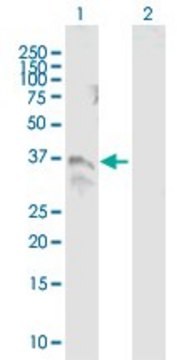 ANTI-TM6SF2 antibody produced in mouse