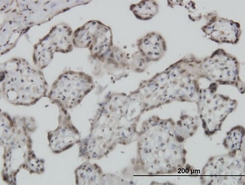 Monoclonal Anti-S100A11 antibody produced in