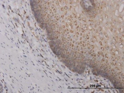 Monoclonal Anti-RPS2 antibody produced in