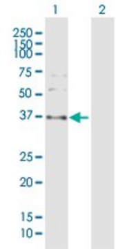 Anti-SPARC antibody produced in rabbit