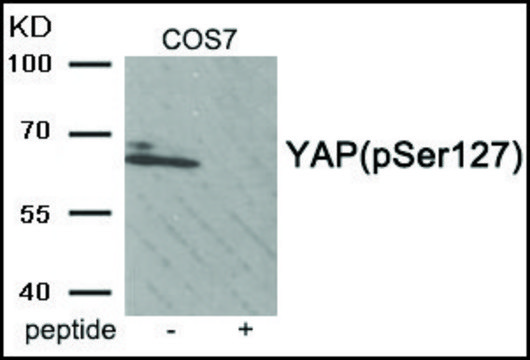 Anti-phospho-YAP (pSer¹²?) antibody produced in