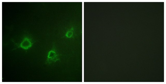 Anti-PLCG1 antibody produced in rabbit