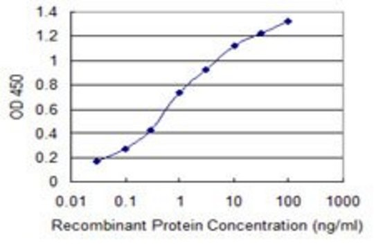 Monoclonal Anti-PIP5K2C antibody produced in