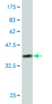 ANTI-RIPK4 antibody produced in mouse