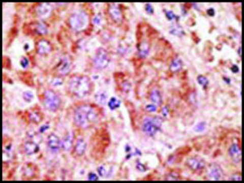 Anti-DSCR1L2 (C-term) antibody produced in