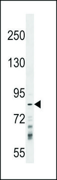 ANTI-RNF219 (CENTER) antibody produced in