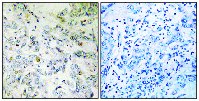 Anti-HCC1 antibody produced in rabbit