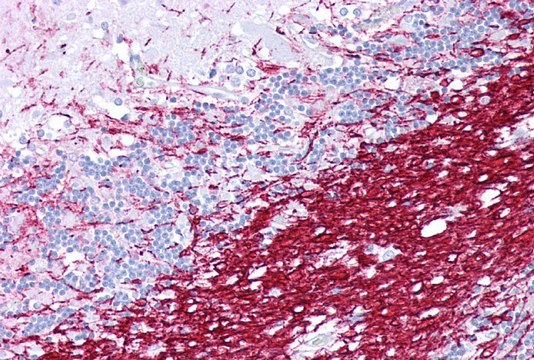 Anti-PLP1 (ab1) antibody produced in