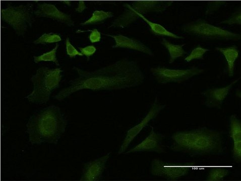 ANTI-ULK2 antibody produced in mouse