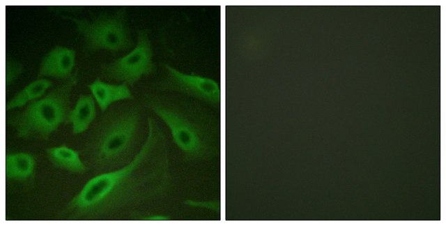 Anti-PLB antibody produced in rabbit