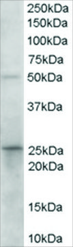 Anti-Prostaglandin Dehydrogenase 1 antibody produced