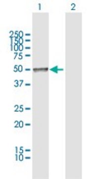 Anti-CHRDL2 antibody produced in rabbit